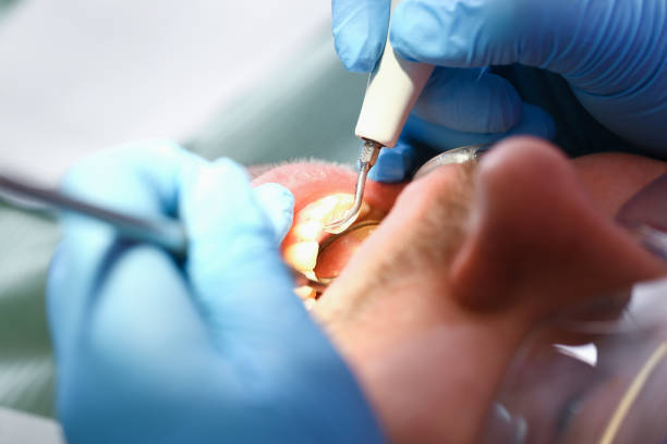 Best Broken Tooth Emergency  in Germantown, OH
