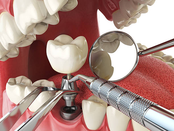 Best Cracked Tooth Emergency Dentist  in Germantown, OH